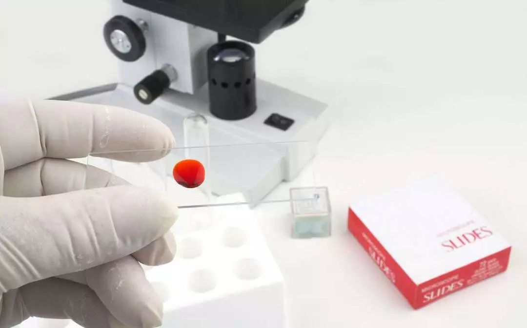 “Knowyourstatus”主动检测,知艾防艾,共享健康