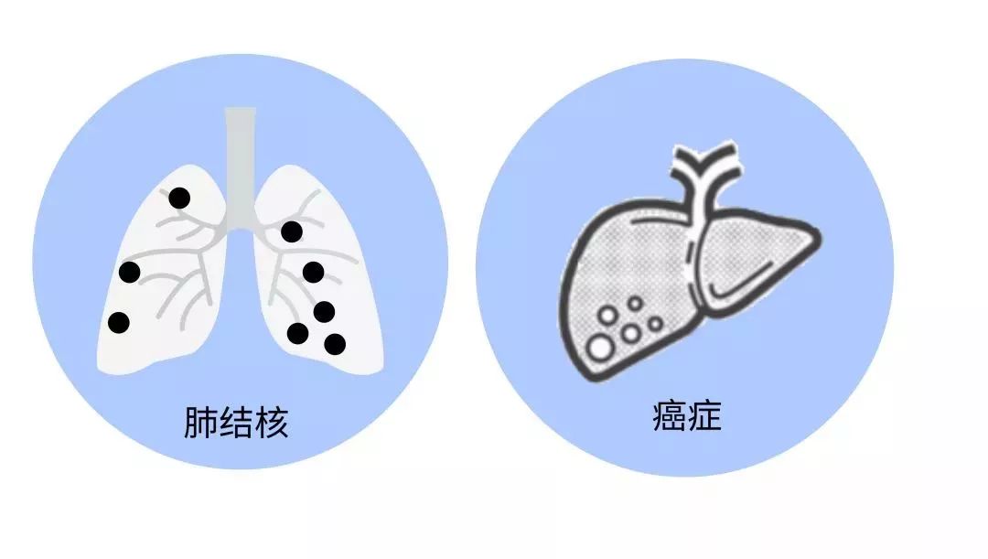 普及｜关于艾滋病，你需要知道什么？