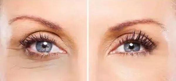 能治黑眼圈的好物推荐,有什么去黑眼圈的平价好物