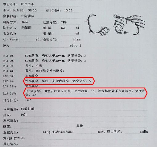 拯救反复心梗发作后心衰患者，积极血运重建和规范药物治疗一个都不能少！
