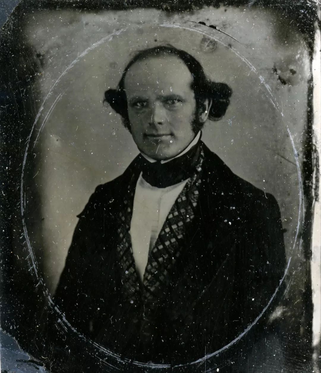 *醚乙**麻醉，科学发明史上最悲怆的故事