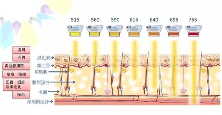 中山七院光子嫩肤特价,中山光子嫩肤推荐