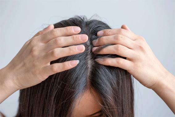 拯救发际线增加发量洗发水,生发发际线的神器测评