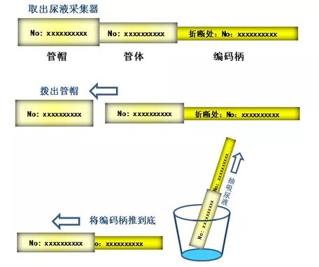 hiv检测试纸是唾液准还是血液准,hiv尿液检测有要求吗