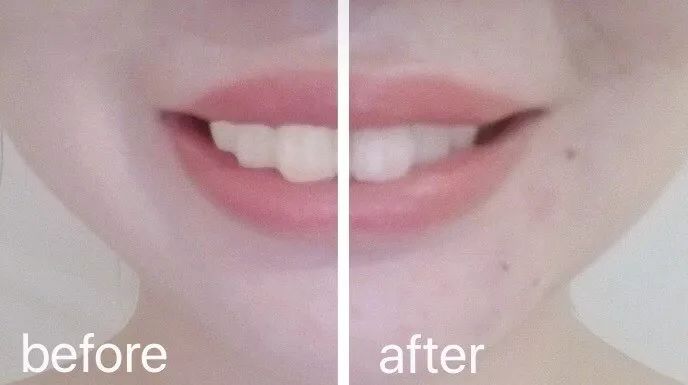 真正美白牙齿的牙膏是哪一款,日本公认最美白的牙膏