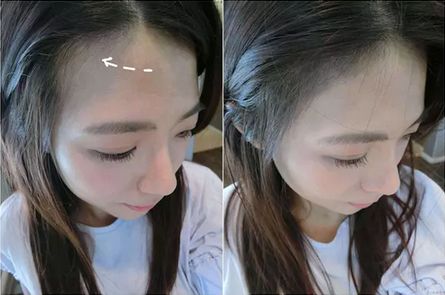 额前新长出的碎发怎么办,额前碎发长出来了