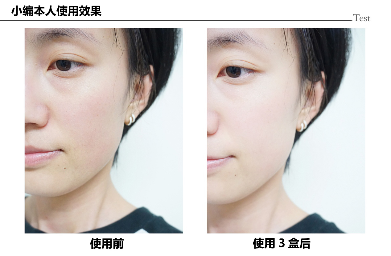 自然兰童颜精华面膜真有那么好吗,自然兰童颜面膜好不好