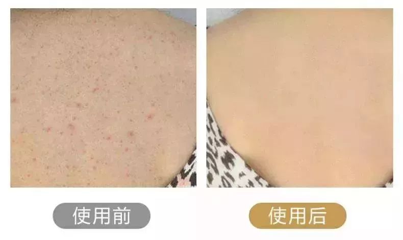 日本沐浴刷,日本muji长柄沐浴刷