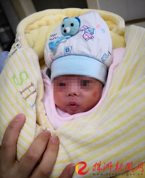出生仅500克婴儿出院,湖南400克袖珍宝宝出院
