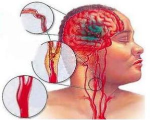 肝功能检查需要提前多久不能进食,肝功能检查前喝了汤