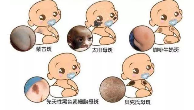 鑳庤鐤ょ棔娌荤枟,鑳庤鐤ょ棔淇妗堜緥