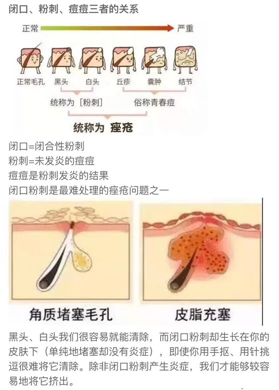 祛痘药膏活动,祛痘医疗活动方案