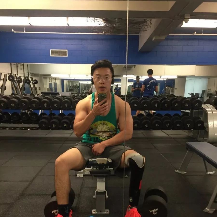 俄罗斯留学生骨折截肢,留学生意外被截肢