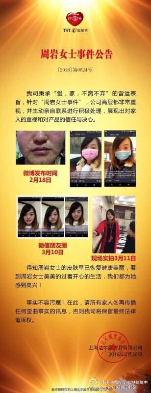 深扒张庭夫妇微商帝国：年缴税21亿，徐峥夫妇站台，产品曾致用户“烂脸”