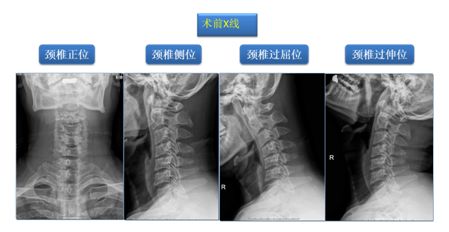 大连开发区筋骨堂正骨推拿,筋骨堂中医正骨推拿简介