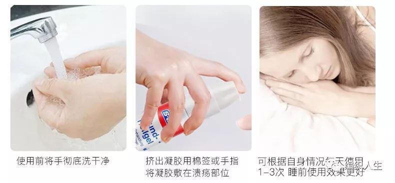 复发性口腔溃疡的特效药,治疗口腔溃疡一个药片就能搞定