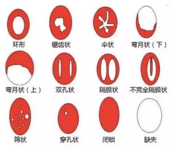 「女科荟」大部分人都错了——处女膜其实不是膜！