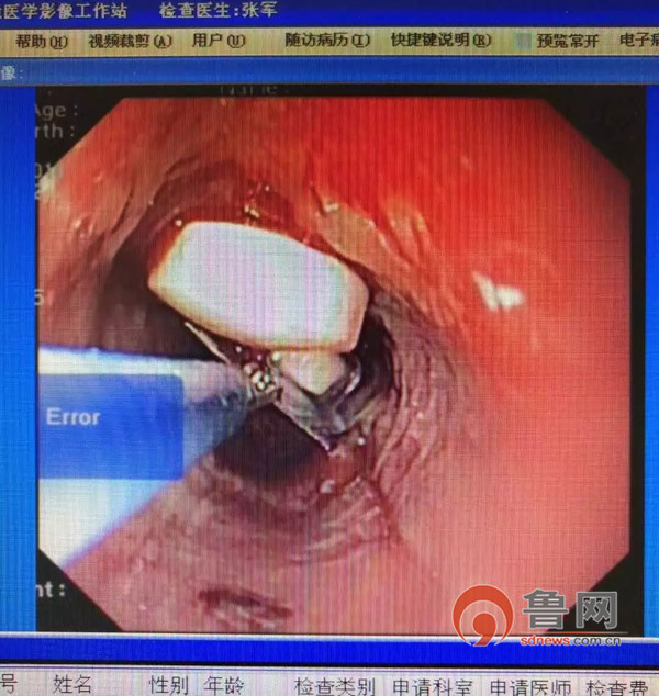平度第三人民医院,平度第三人民医院医生会做手术吗