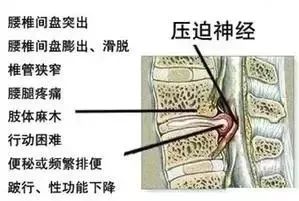 情人节福利,情人节福利秒杀