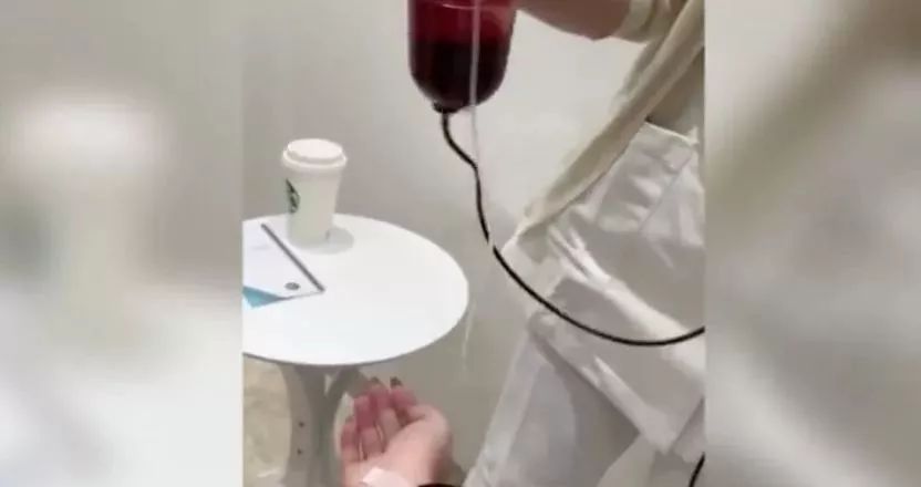 减肥出大事！23岁姑娘紧急“换肝”捡回一条命！