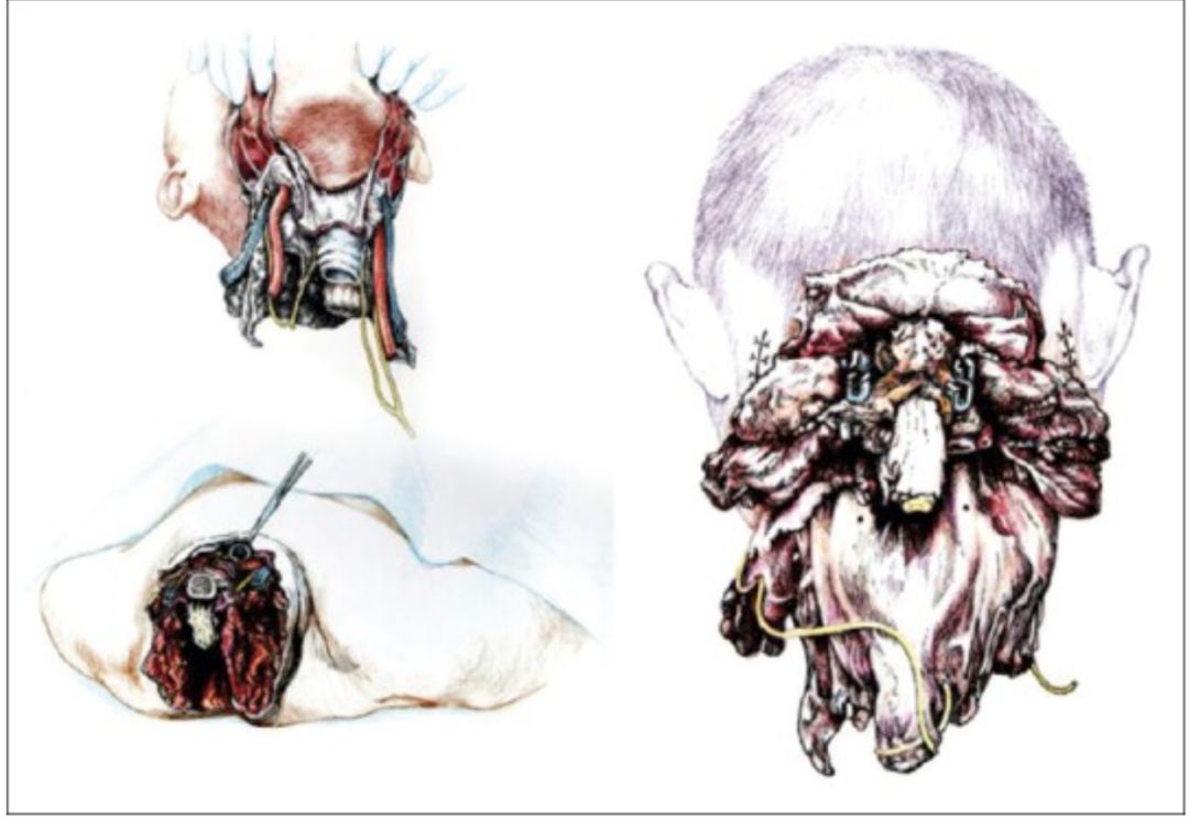 杨永信被送进戒网瘾学校,被杨永信戒断网瘾的孩子