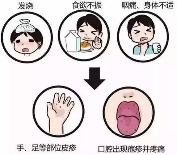 手足口病要谨记什么,手足口病没有你想的那么可怕