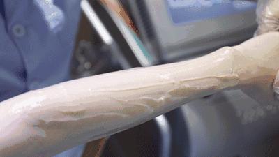 10分钟永久全身脱毛，给你一个滑溜溜的夏天