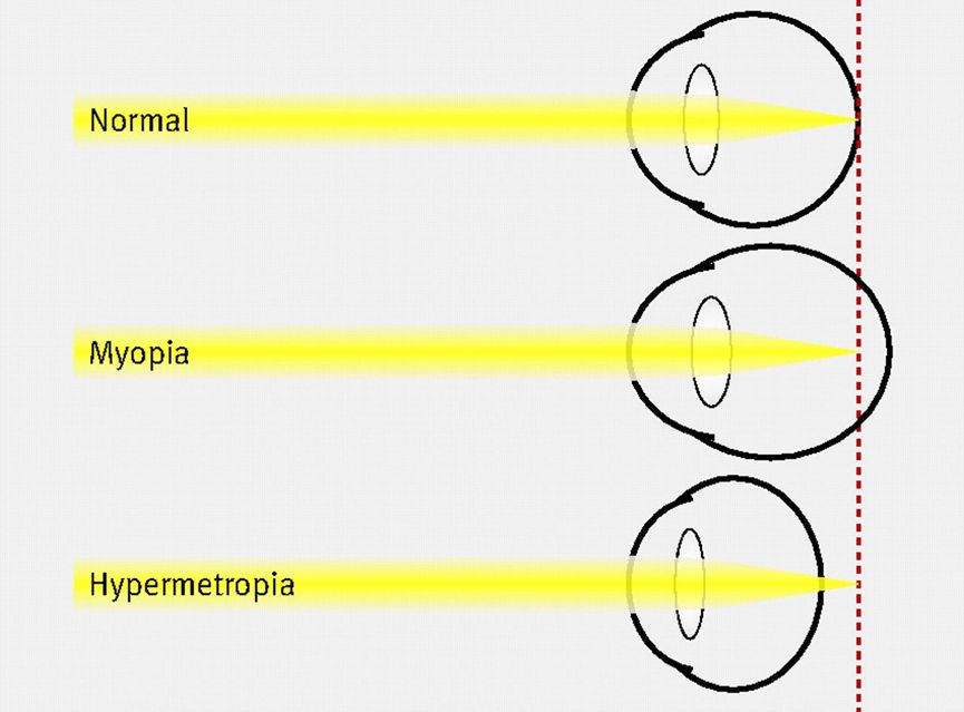 为了身体健康杜绝电子产品,保护视力拒绝电子产品小学生