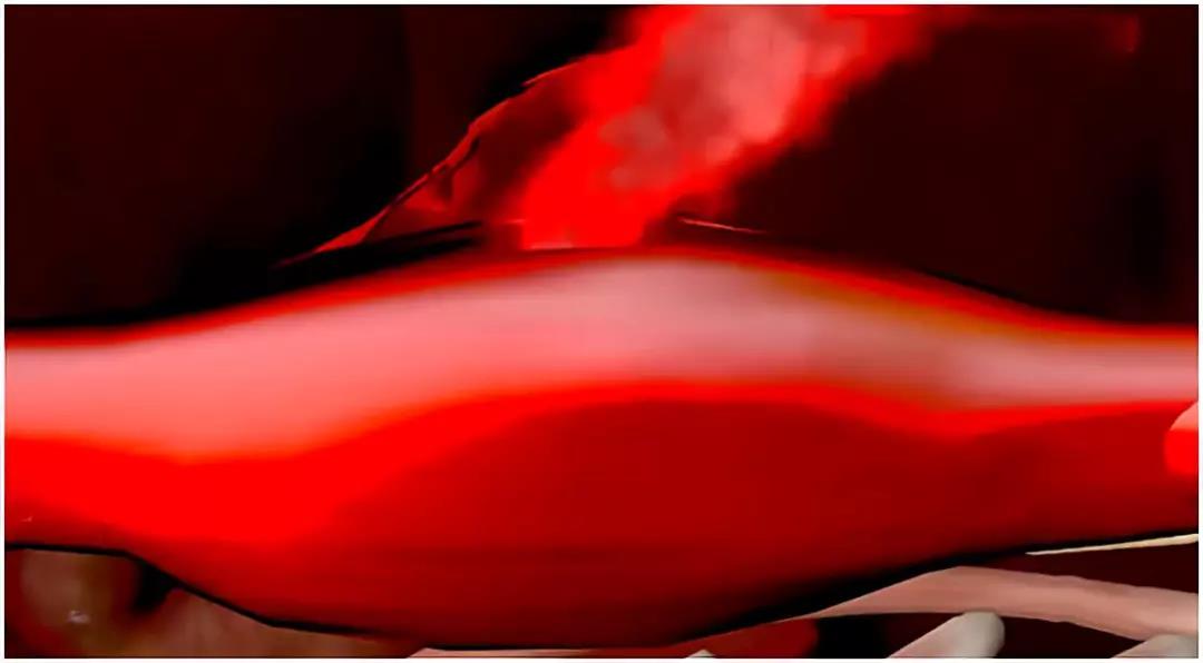 头痛鼻塞喉咙痛咳嗽嘴唇起泡,咳嗽喉咙痛头痛是什么原因