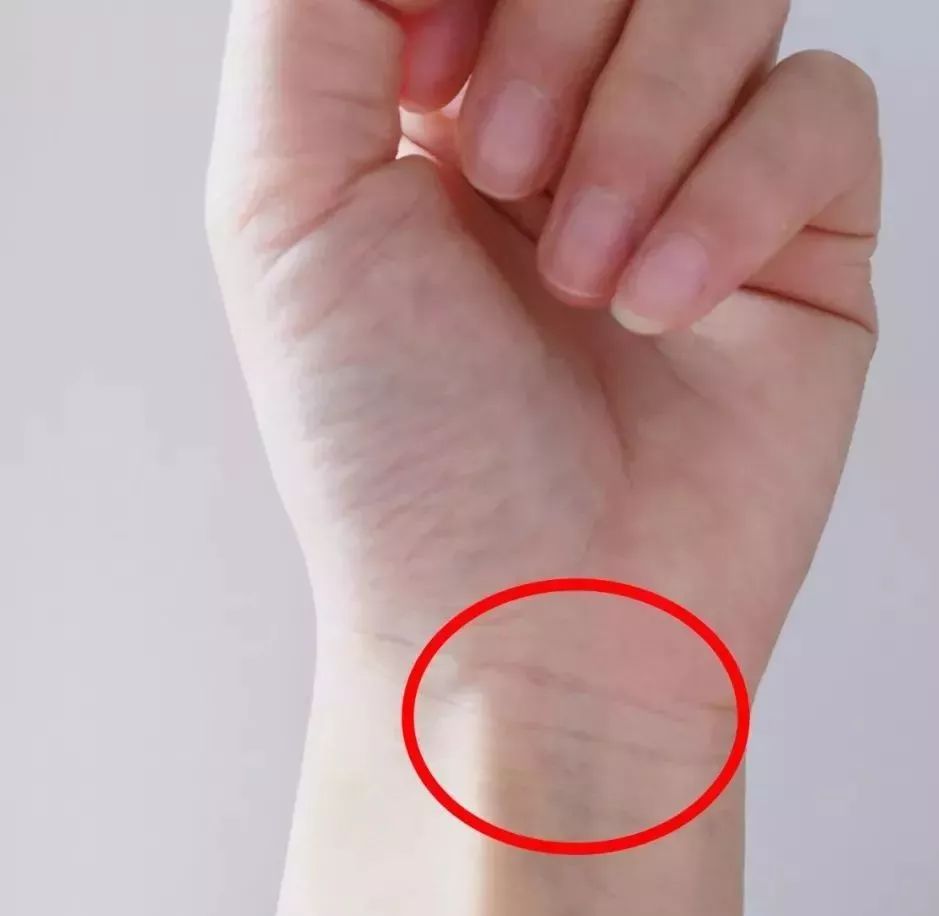 为什么手下垂手背上青筋暴露出来,手血管突出青筋暴起是什么原因