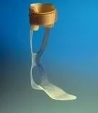 刚出生就要打石膏?硬核医生手工打造矫形器治疗足外翻