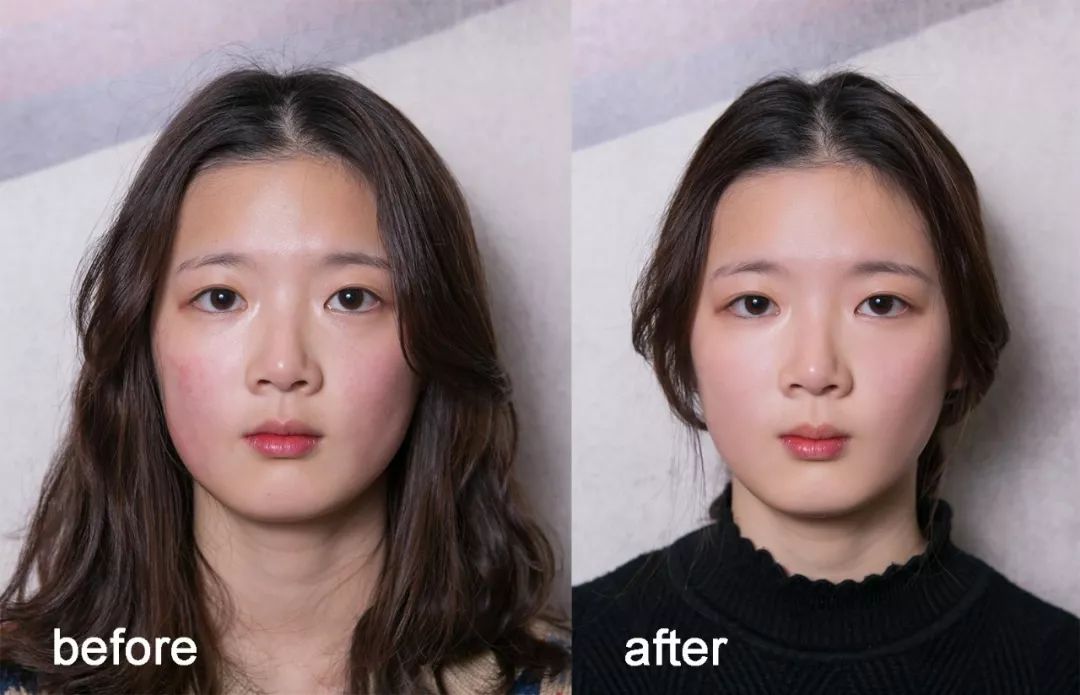 小茂肌诊室到底有多强,小茂肌诊室皮肤状态