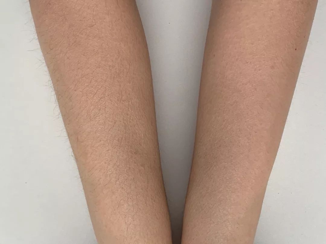 大促限时优惠,大促限时秒杀