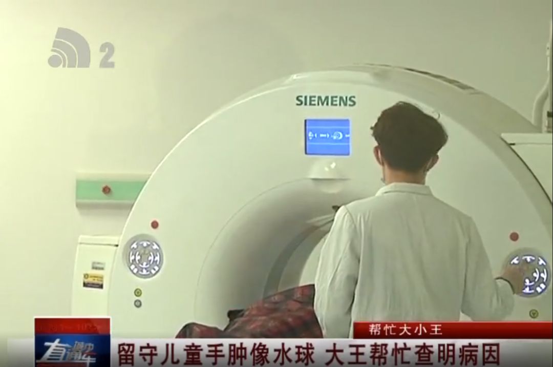 帮忙大小王|留守儿童手肿像水球大王帮忙查明病因