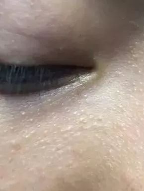 姑娘，我看你双目涣散、唇周长毛、乳晕发黑......