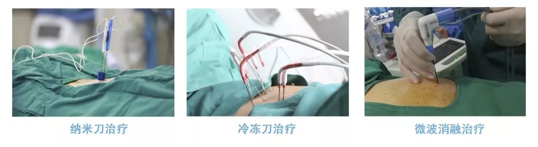 冷冻治疗八次又复发,冷冻复苏成功案例