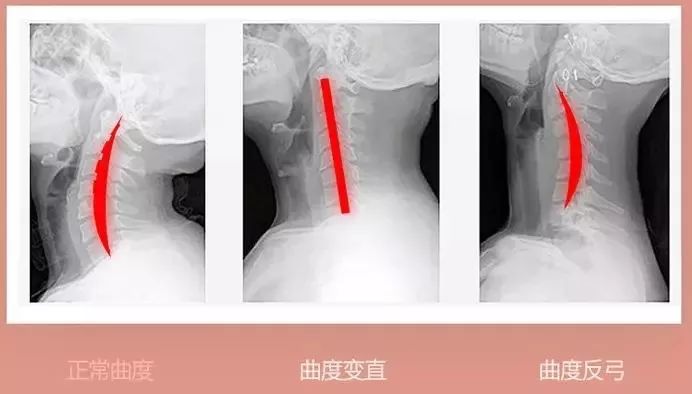 颈肩腰疼用什么热敷,颈肩腰痛小偏方