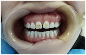 口腔医院皓齿,皓齿美白诊室流程