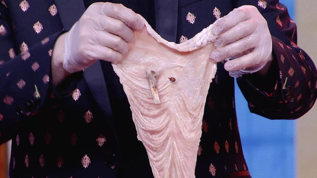 今日养生堂节目回放,养生堂今日最新预告