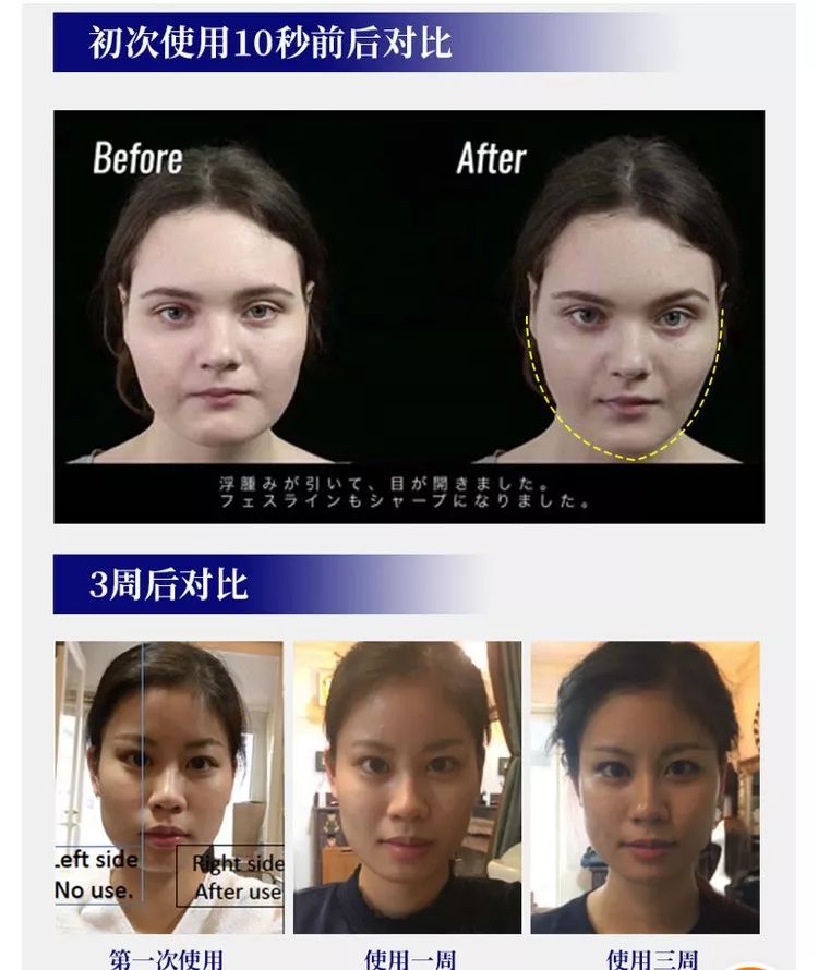 不削骨改变脸型,不削骨变脸型