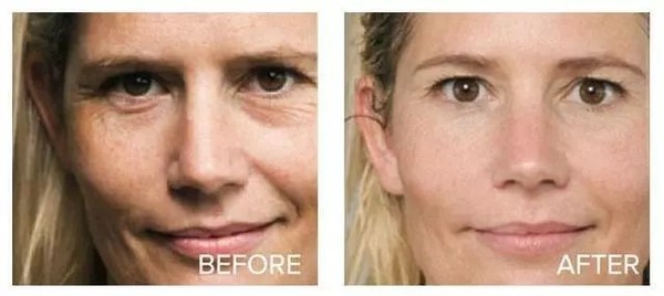 美白针出名的牌子,美白针品牌成分