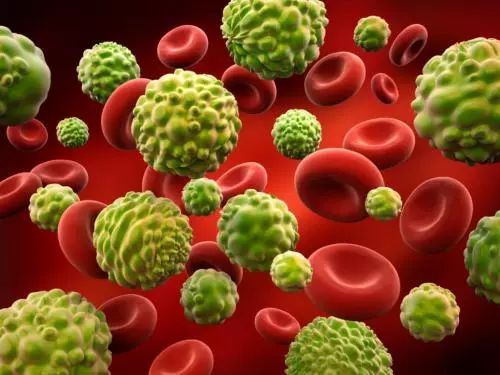 科学抗癌的方法,科学抗癌少走弯路