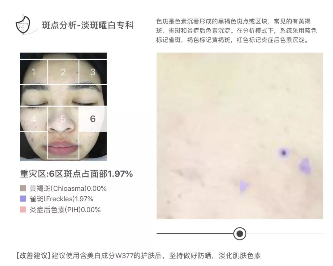 灏忚寕鑲岃瘖瀹よˉ姘村悧,灏忚寕鑲岃瘖瀹ゅ埌搴曟湁澶氬己