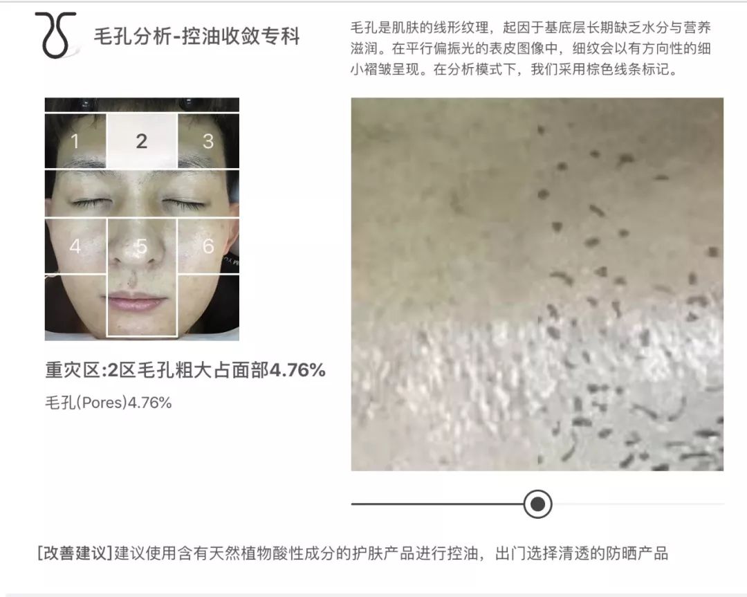 灏忚寕鑲岃瘖瀹ゅ埌搴曟湁澶氬己,灏忚寕鑲岃瘖瀹よˉ姘村悧