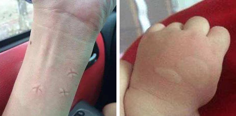 天然无害驱蚊品,天然环保无异味