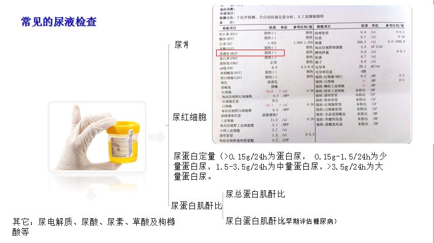 科普肾脏,医学科普出汗和肾脏关系