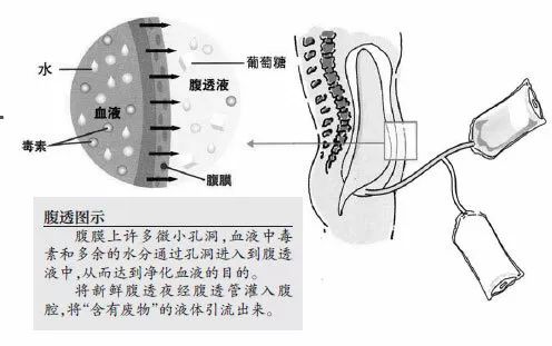 科普肾脏,医学科普出汗和肾脏关系