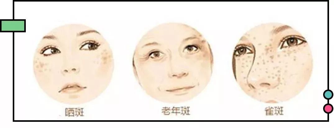 怀孕变丑真正原因,什么时候怀孕变难看