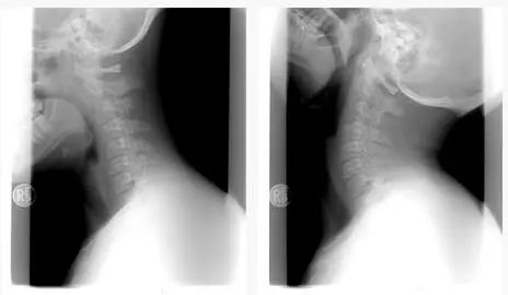身体五个危险三角区,人体三角区有哪些危险