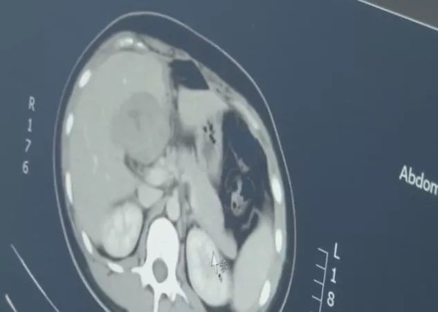 罕见骨盆畸形产妇在我院顺利产子,罕见双子宫产妇顺利产下双胞胎